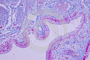 Columnar epithelium of human gall bladder under the microscope in Lab.