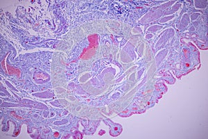 Columnar epithelium of human gall bladder under the microscope in Lab.