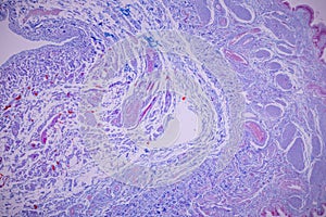 Columnar epithelium of human gall bladder under the microscope in Lab.