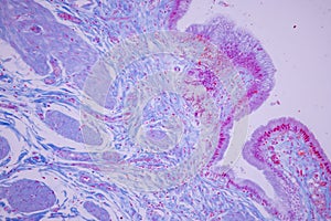 Columnar epithelium of human gall bladder under the microscope in Lab.