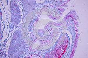 Columnar epithelium of human gall bladder under the microscope in Lab.