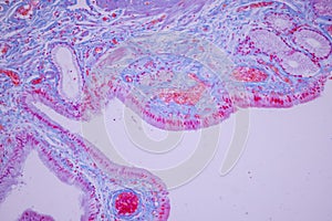 Columnar epithelium of human gall bladder under the microscope in Lab.