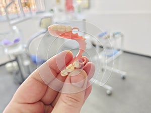combined removable denture based on acetone and acrylic