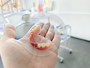 combined removable denture based on acetone and acrylic