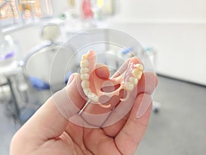 combined removable denture based on acetone and acrylic