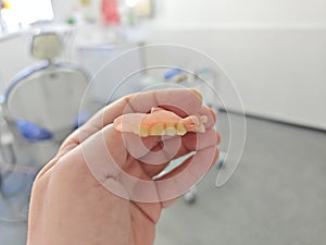 combined removable denture based on acetone and acrylic