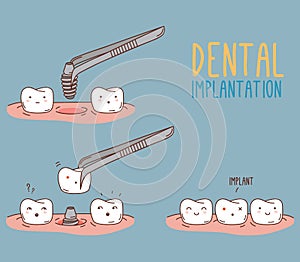 Comics about tooth replacement. Vector