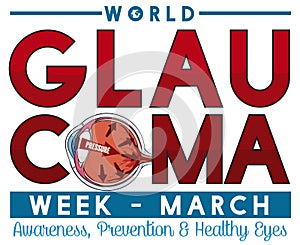 Commemorative Design for Glaucoma Week in March with Sick Eye, Vector Illustration