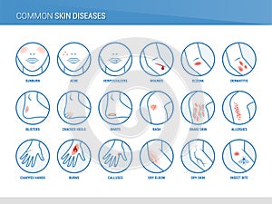 Common skin diseases