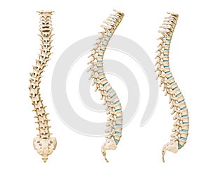 Common spinal disorders 3D rendering illustration isolated on white background. Scoliosis, lordosis and kyphosis curvature of the
