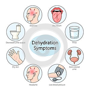 Dehydration Symptoms diagram medical science photo