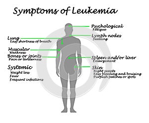 Common Symptoms of Leukemia