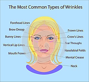 Common Types of Facial Wrinkles. cosmetic surgery. woman facial treatment isolated