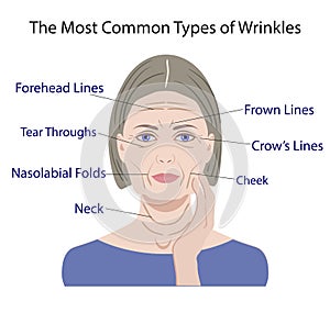 Common Types of Facial Wrinkles. cosmetic surgery. woman facial treatment photo