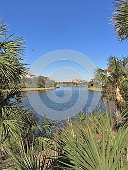 Community lake in a residential area surrounded by homes