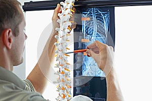 Comparative analysis of spine - model and x-ray photo photo