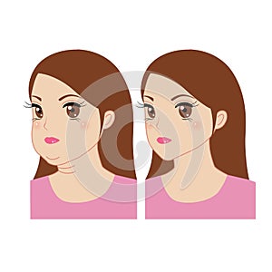 Compared before and after young thin and overweight women with a double chin and wrinkles, illustration on white background