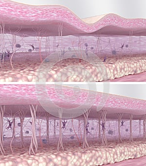 Comparison of 3D illustrations of young and aged skin