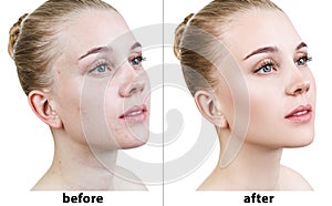 Portrait of woman before and after retouch. photo