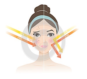 Comparison of damaged and healthy skin vector illustration on white background. photo