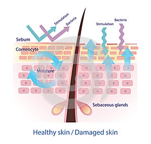 Comparison of healthy and damaged skin barrier vector on white background. photo