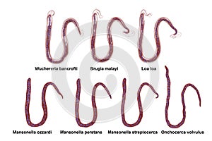 Comparison of microfilariae morphology