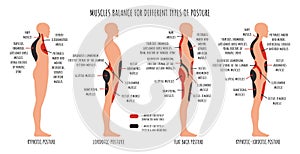 Comparison of muscle imbalance in various postural disorders. Kyphotic, lordotic, flat back posture infographics