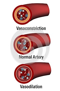 Comparison of normal, vasoconstriction and vasodilation blood vessels with cross section of arteries photo