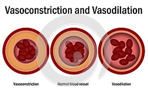 Comparison of normal, vasoconstriction and vasodilation blood vessels with cross section of arteries photo