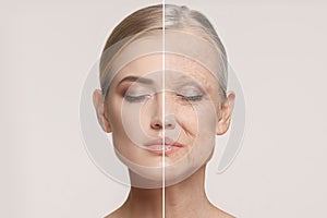 Comparison. Portrait of beautiful woman with problem and clean skin, aging and youth concept, beauty treatment