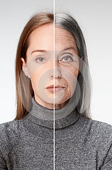 Comparison. Portrait of beautiful woman with problem and clean skin, aging and youth concept, beauty treatment