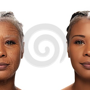 Comparison. Portrait of beautiful woman with problem and clean skin, aging and youth concept, beauty treatment and