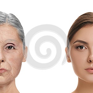 Comparison. Portrait of beautiful woman with problem and clean skin, aging and youth concept, beauty treatment and