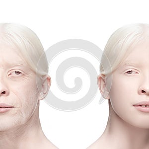 Comparison. Portrait of beautiful woman with problem and clean skin, aging and youth concept, beauty treatment and