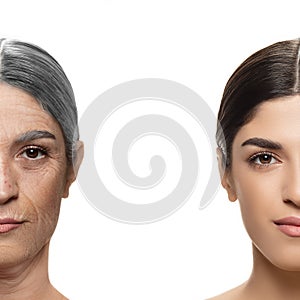 Comparison. Portrait of beautiful woman with problem and clean skin, aging and youth concept, beauty treatment and