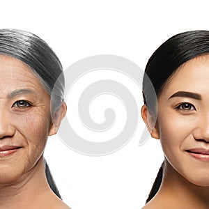 Comparison. Portrait of beautiful woman with problem and clean skin, aging and youth concept, beauty treatment and