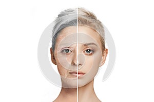 Comparison. Portrait of beautiful woman with problem and clean skin, aging and youth concept, beauty treatment and