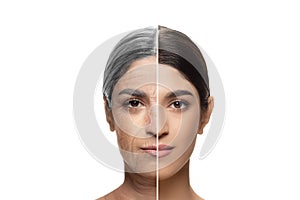 Comparison. Portrait of beautiful woman with problem and clean skin, aging and youth concept, beauty treatment and