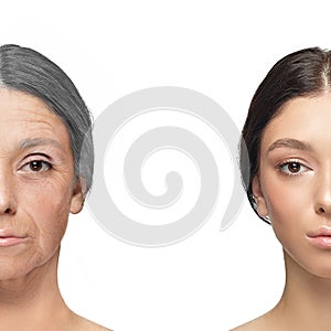 Comparison. Portrait of beautiful woman with problem and clean skin, aging and youth concept, beauty treatment and