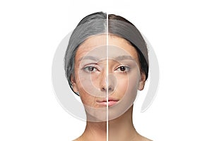 Comparison. Portrait of beautiful woman with problem and clean skin, aging and youth concept, beauty treatment and