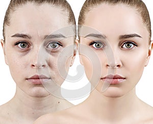 Comparison portrait of young woman before and after retouch