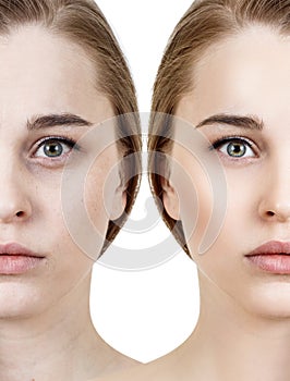 Comparison portrait of young woman before and after retouch.