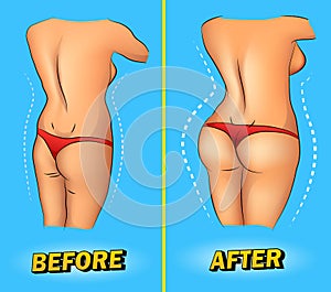 Comparison of skinny female buttocks and tightened after traininComparison of skinny female buttocks and tightened