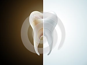 Comparison of tooth