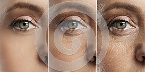 Comparison of young, middle aged and elderly age.