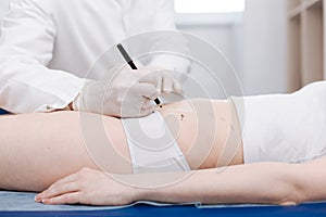 Competent skillful doctor preparing patients belly for liposuction