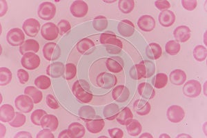 Complete blood count