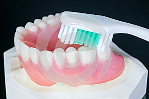 Complete denture or full denture.