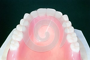 Complete denture or full denture.