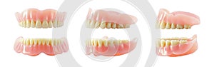 Complete Dentures